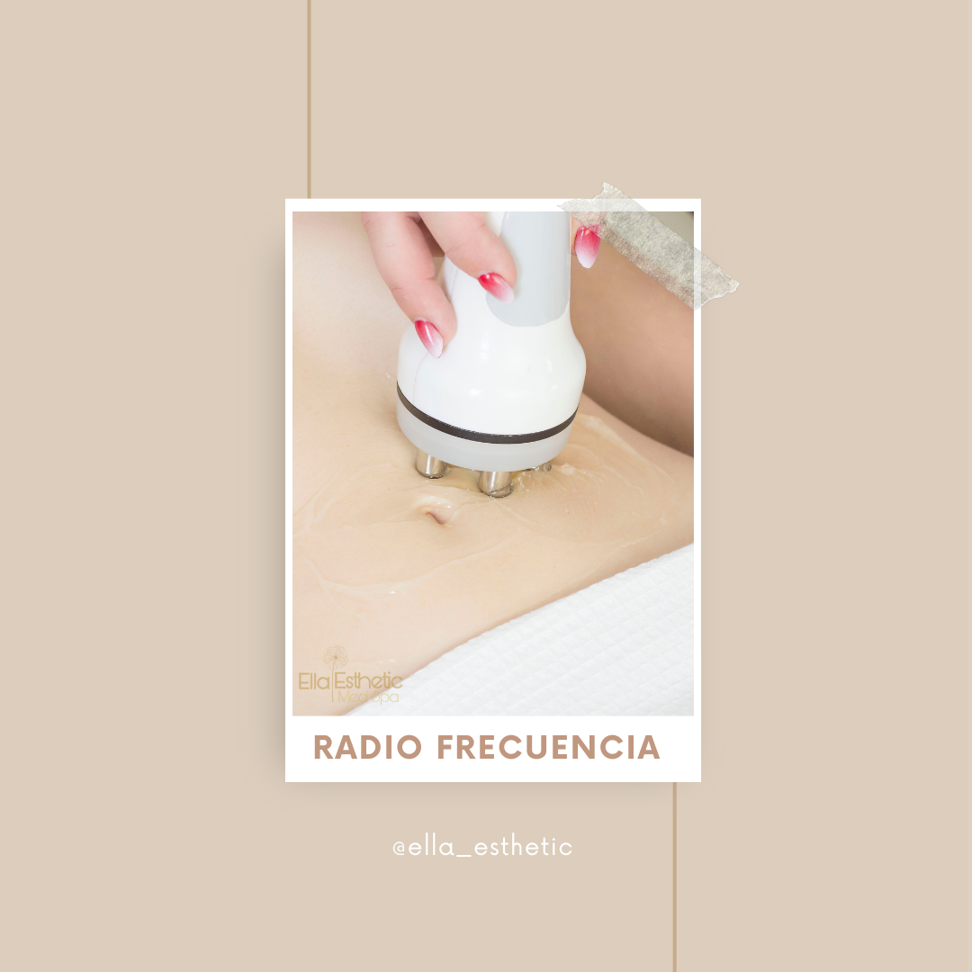 RADIO FRECUENCIA